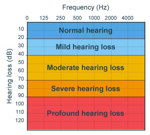 level-of-hearing-loss